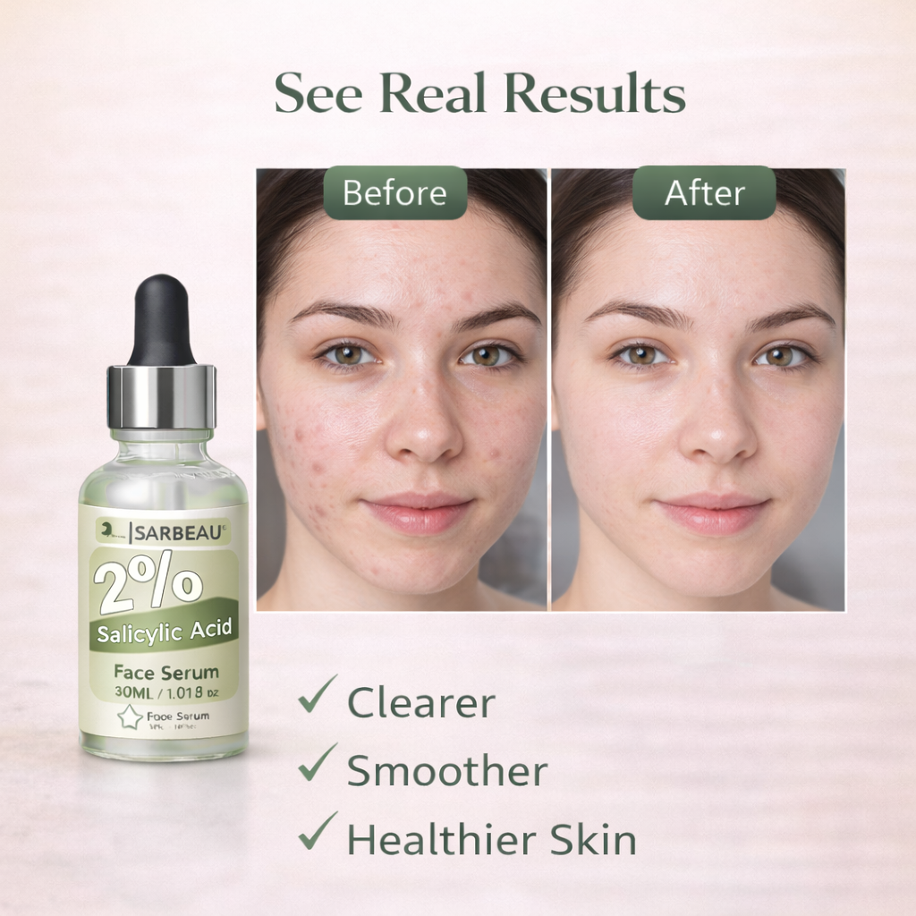 Sarbeau 2% Salicylic Acid Face Serum | Lightweight Exfoliating Serum for Oily & Acne-Prone Skin | 30ml