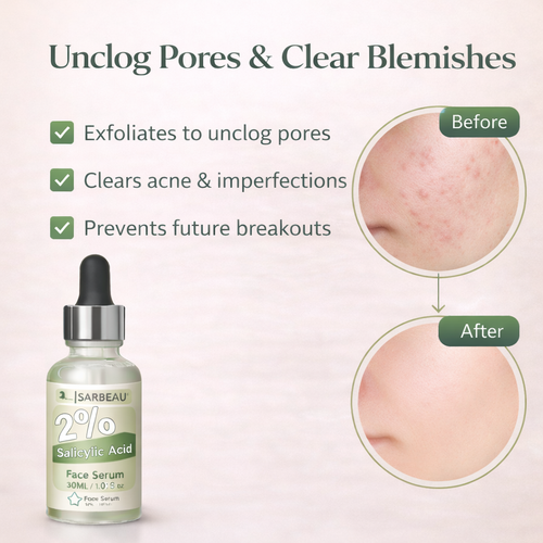 Sarbeau 2% Salicylic Acid Face Serum | Lightweight Exfoliating Serum for Oily & Acne-Prone Skin | 30ml